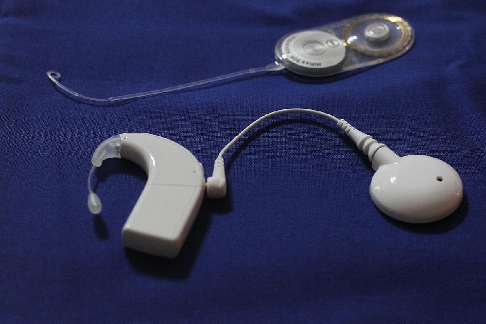 cochlear-implants-give-the-gift-of-hearing-but-they-re-not-for-everyone