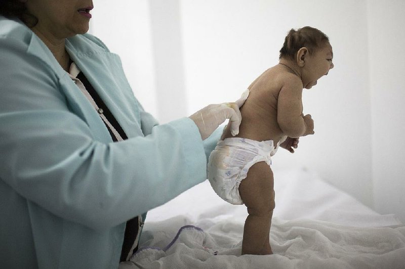 Lara, who is less then 3 months old and was born with microcephaly, is examined by a neurologist Feb. 12 at the Pedro I hospital in Campina Grande, Paraiba state, Brazil. 