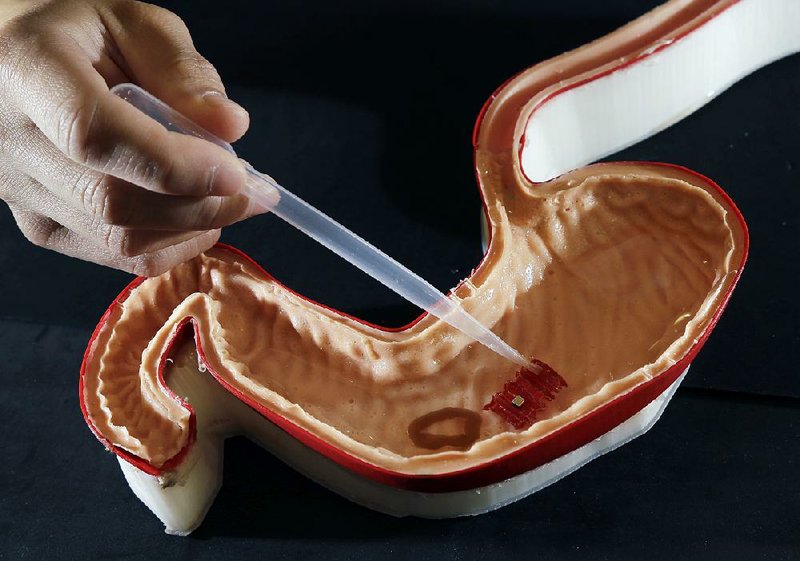 Steven Guitron, a mechanical engineering graduate student at the Massachusetts Institute of Technology in Cambridge, Mass., points a pipette at a tiny origami robot floating toward a wound in a stomach model.