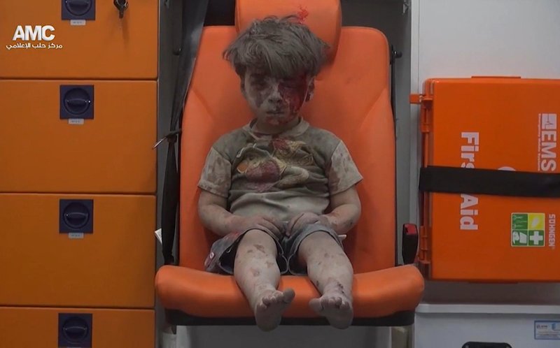 In this frame grab taken from video provided by the Syrian anti-government activist group Aleppo Media Center (AMC), 5-year-old Omran Daqneesh sits in an ambulance after being pulled out or a building hit by an airstirke, in Aleppo, Syria, Wednesday, Aug. 17, 2016. 