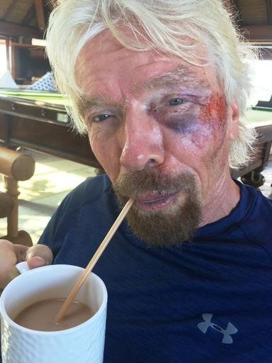 Undated handout image issued by Virgin.com oFriday Aug. 26, 2016, of Sir Richard Branson after he was involved in an accident when he crashed his bicycle on Virgin Gorda, one of the British Virgin Islands in the Caribbean. 