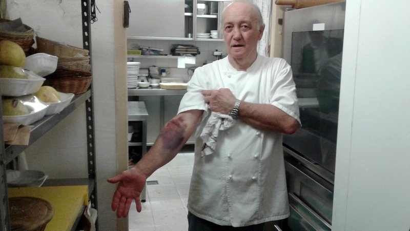 Restaurant owner Mario Cattaneo shows the bruise on his arm which according to one version he has given he says he received when grabbed on the arm by a thief after the thief broke into his restaurant in the middle of the night Friday, in his restaurant's kitchen in Casaletto Lodigiano near Lodi in northern Italy, Sunday, 12 March 2017. Italian politicians from the far right and former Premier Silvio Berlusconi's center-right part are demanding a new law on legitimate defense to protect law-abiding citizens after Cattaneo is being investigated for murder for allegedly fatally shooting the thief in the back. 