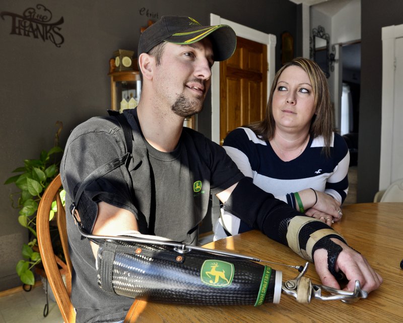 In this Feb. 25, 2014, photo, Little Falls, Minn., resident Jamie Houdek, with his wife, Lisa, at his side, talks about his recovery after he lost his right hand to a corn picker in November 2013 on the 60-acre hobby farm where he raises beef cattle. The nation's growing embrace of small-scale production of local and organic crops is leading to more farm injuries and deaths among amateur growers. Experts say some novices have little appreciation of the occupation's dangers. (Kimm Anderson /St. Cloud Times via AP)