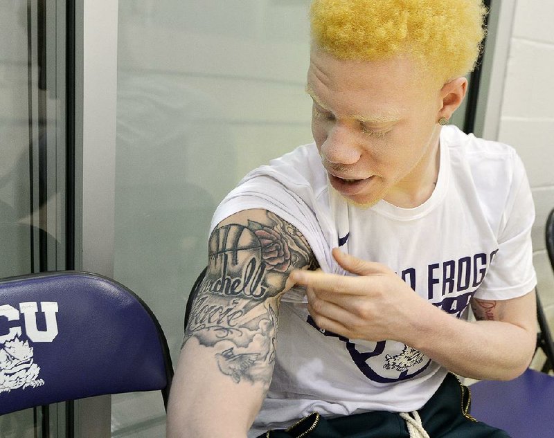 TCU sophomore point guard Jaylen Fisher used basketball to overcome his anxiety about being an albino as he was growing up. He even used it as motivation during an AAU game in Arkansas when an opposing player doubted his ability because of his albinism. 