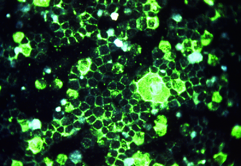 Antibodies to respiratory syncytial virus glow green under ultraviolet light in this photo taken through a microscope using indirect immunofluorescence. RSV is the most common cause of bronchiolitis and pneumonia among children under 1 year of age.