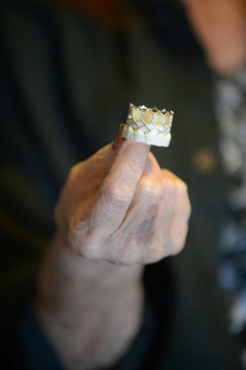 NWA Democrat-Gazette/ANDY SHUPE Mary Anne Erlinger of Springdale holds a model of a coronary valve March 8, similar to one doctors used to repair her heart using a less invasive method.