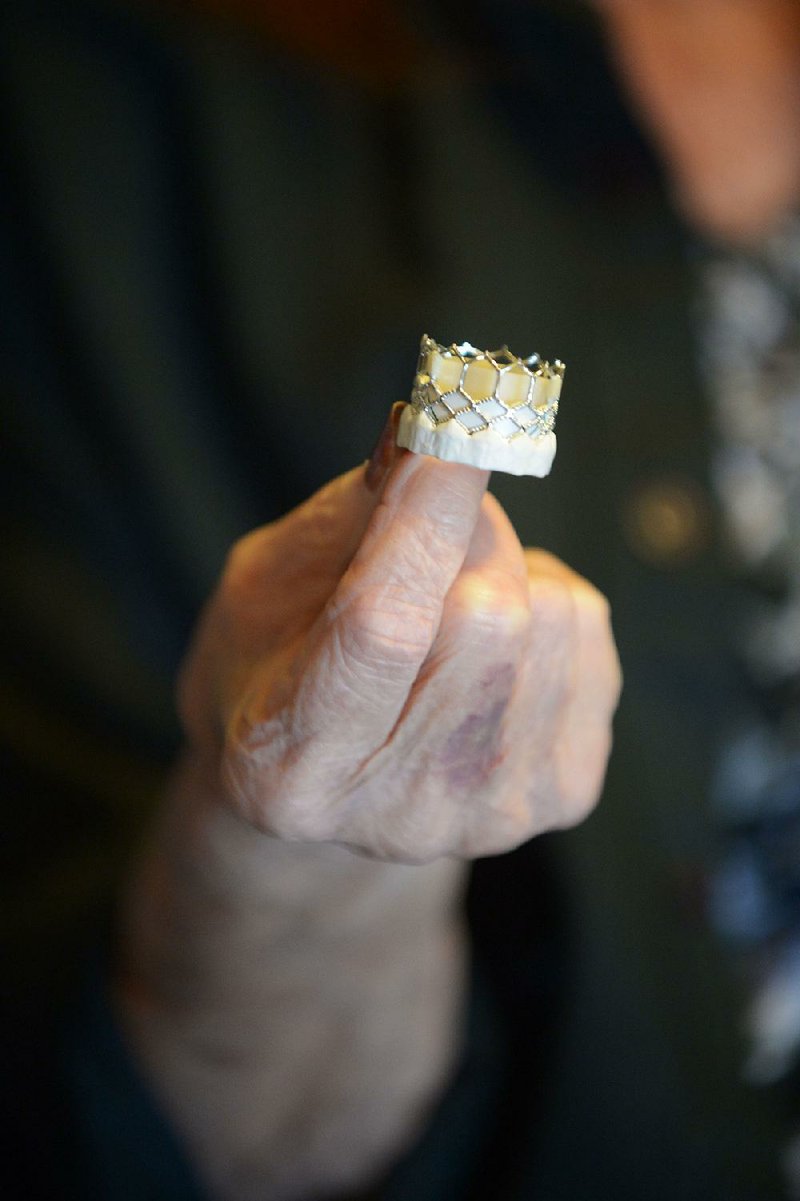 Mary Anne Erlinger of Springdale holds a model of a coronary valve similar to one doctors used to repair her heart.