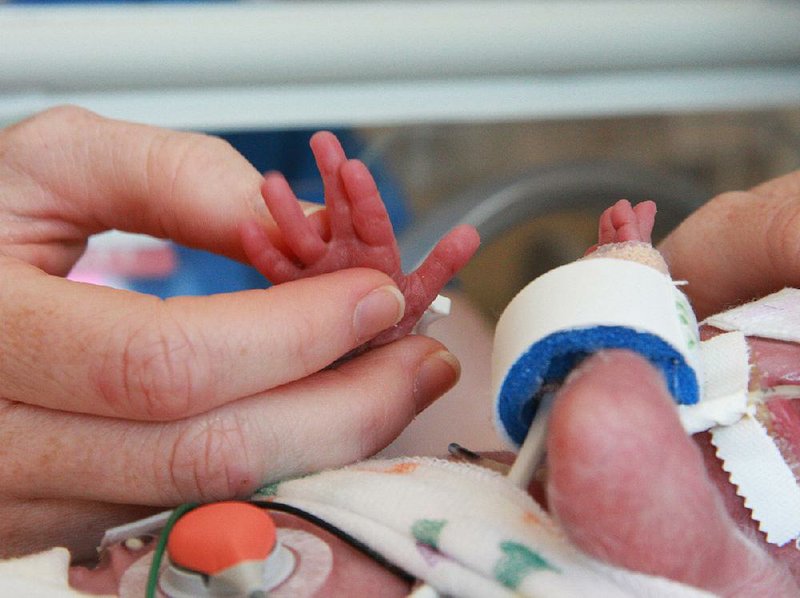 Doctors and officials say years of increasing opioid use — and misuse — have caused a significant increase in cases of drug-dependent newborns, who face harrowing stays in intensive care nurseries.  