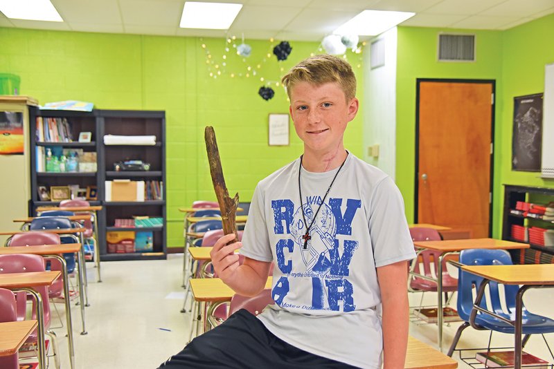 Zane Hill, a seventh-grader at Goza Middle School in Arkadelphia, shows off part of a branch that impaled him in the neck in a boating accident on June 10. Hill said he kept the stick as a trophy.