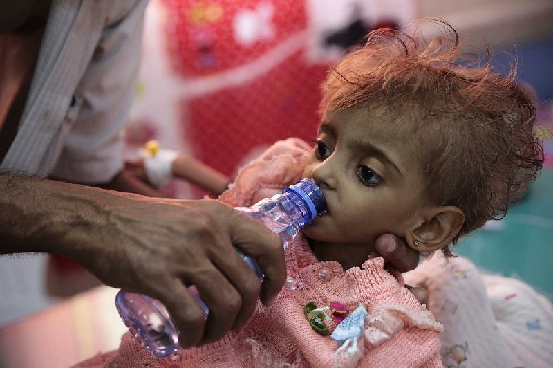 A father gives water to his malnourished daughter on Sept. 27 at a hospital feeding center in the embattled port city of Hodeida, the main port for Yemen’s food imports and international aid. 