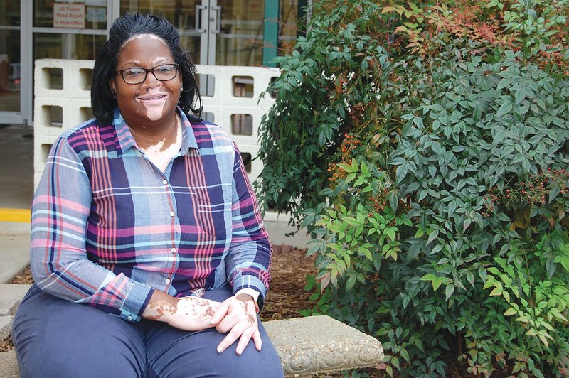 Karen Ford, a special-education paraprofessional for Perritt Primary School in the Arkadelphia School District, was diagnosed with vitiligo when she was 10 years old. She was recently named the district’s Classified Employee of the Year.