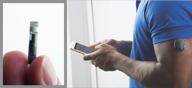 The Eversense Continuous Glucose Monitoring System includes an implant that goes beneath the skin (left) and (at right) a transmitter applied over the skin and a phone app. (Senseonics)