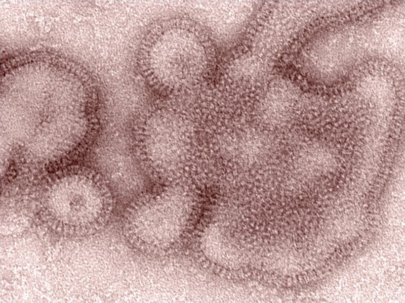This 2011 electron microscope image provided by the Centers for Disease Control and Prevention shows H3N2 influenza virions. In January 2019, the flu season was shaping up to be one of the shortest and mildest in recent U.S. history. But a surprising second viral wave has just made it the longest, according to the flu statistics released on Friday, April 19, 2019. (Dr. Michael Shaw, Doug Jordan/Centers for Disease Control and Prevention via AP)