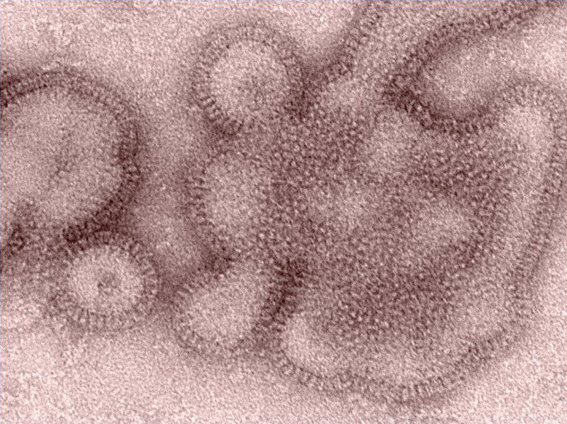 FILE - This 2011 electron microscope image provided by the Centers for Disease Control and Prevention shows H3N2 influenza virions. In January 2019, the flu season was shaping up to be one of the shortest and mildest in recent U.S. history. But a surprising second viral wave has just made it the longest, according to the flu statistics released on Friday. (Dr. Michael Shaw, Doug Jordan/Centers for Disease Control and Prevention via AP)

