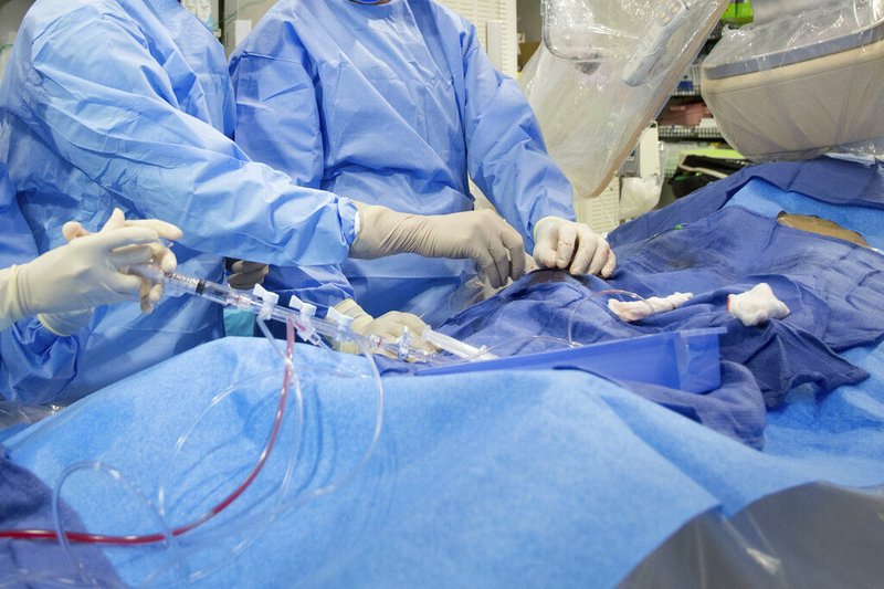 In this Feb. 16, 2017 file photo, surgeons perform a non-emergency angioplasty at Mount Sinai Hospital in New York. Through a blood vessel in the groin, a tube is guided to a blockage in the heart. 