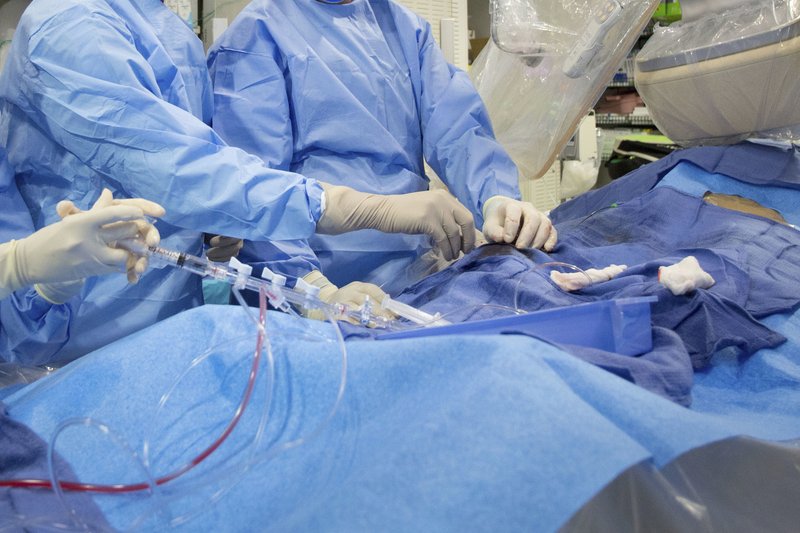 In this Feb. 16, 2017, file photo, surgeons perform a non-emergency angioplasty at Mount Sinai Hospital in New York. Through a blood vessel in the groin, a tube is guided to a blockage in the heart. A tiny balloon is then inflated to flatten the clog, and a mesh tube called a stent is inserted to prop the artery open. According to a federally funded study released on Saturday, people with severe but stable heart disease from clogged arteries may have less chest pain if they get a procedure to improve blood flow rather than just giving medicines a chance to help, but it won't cut their risk of having a heart attack or dying over the following few years. - AP Photo/Mark Lennihan