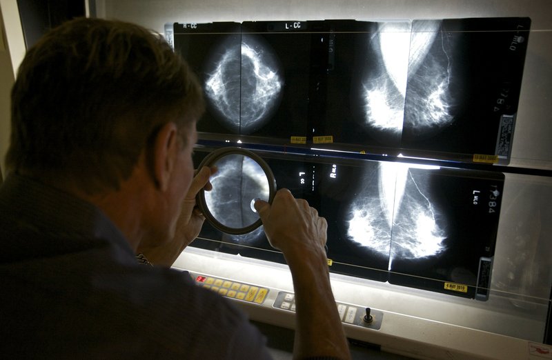 FILE - In this May 6, 2010 file photo, a radiologist checks mammograms in in Los Angeles. Women who use certain types of hormones after menopause still have an increased risk of developing breast cancer nearly two decades after they stop taking the pills, long-term results from a big federal study suggest. (AP Photo/Damian Dovarganes, File)
