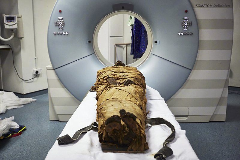 The mummy of Nesyamun, a priest who lived in Thebes about 3,000 years ago, is ready for CT scanning in this undated photo. (The New York Times/Leeds Teaching Hospitals/Leeds Museums and Galleries)