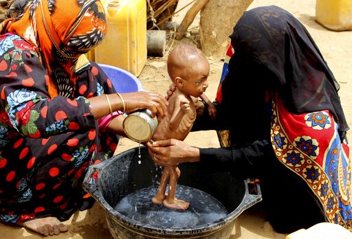 In this Aug. 25, 2018, file photo, a severely malnourished infant is bathed in a bucket in Aslam, Hajjah, Yemen. Houthi rebels in Yemen have blocked half of the United Nations' aid delivery programs in the war-torn country -- a strong-arm tactic to force the agency to give them greater control over the massive humanitarian campaign, along with a cut of billions of dollars in foreign assistance, according to aid officials and internal documents obtained by The Associated Press. - AP Photo/Hammadi Issa