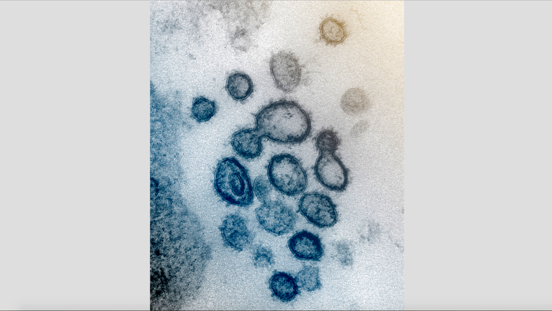 This undated electron microscope image made available by the U.S. National Institutes of Health in February 2020 shows the Novel Coronavirus SARS-CoV-2. Also known as 2019-nCoV, the virus causes covid-19.