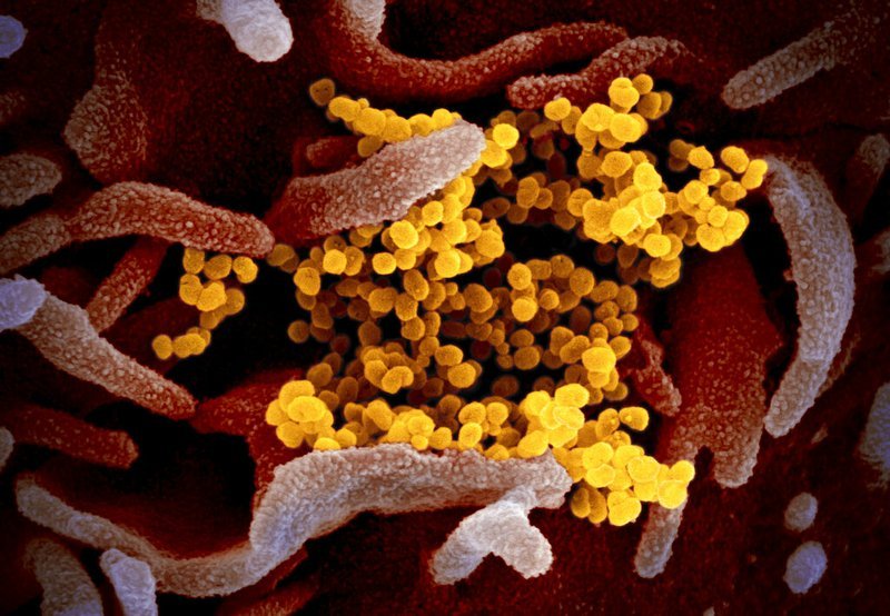 This undated electron microscope image made available by the U.S. National Institutes of Health in February 2020 shows the Novel Coronavirus SARS-CoV-2, yellow, emerging from the surface of cells, pink, cultured in the lab. Also known as 2019-nCoV, the virus causes covid-19. The sample was isolated from a patient in the U.S. On Thursday, March 5, 2020, Tennessee's Department of Health Commissioner Lisa Piercey confirmed the state's first case of the new coronavirus. (NIAID-RML via AP) 