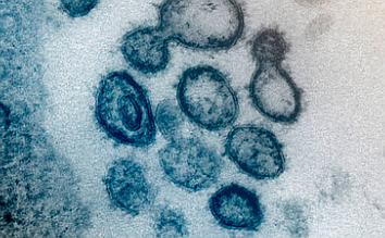 This undated electron microscope image made available by the U.S. National Institutes of Health in February 2020 shows the Novel Coronavirus SARS-CoV-2. Also known as 2019-nCoV, the virus causes covid-19. - Photo by NIAID-RML via AP