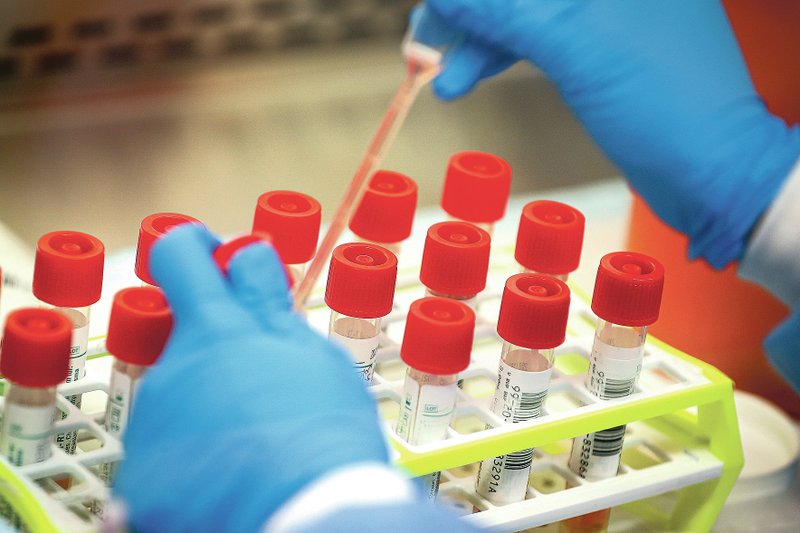 A technician prepares covid-19 coronavirus patient samples March 11 for testing at a laboratory in New York's Long Island. A series of missteps at the nation's top public health agency caused a critical shortage of reliable laboratory tests for the coronavirus, hobbling the federal response as the pandemic spread across the country like wildfire, an Associated Press review found. (AP/John Minchillo)