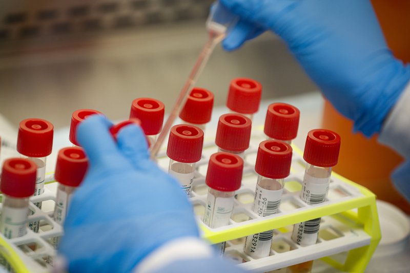 FILE - In this Wednesday, March 11, 2020 file photo, a technician prepares COVID-19 coronavirus patient samples for testing at a laboratory in New York's Long Island. A series of missteps at the nation's top public health agency caused a critical shortage of reliable laboratory tests for the coronavirus, hobbling the federal response as the pandemic spread across the country like wildfire, an Associated Press review found. (AP Photo/John Minchillo)