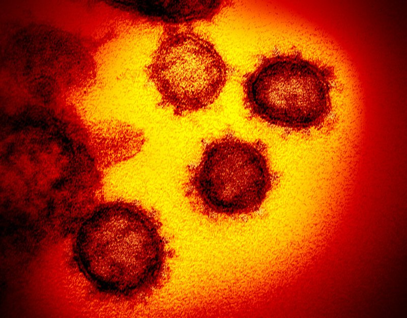 FILE - This undated electron microscope image made available by the U.S. National Institutes of Health in February 2020 shows the Novel Coronavirus SARS-CoV-2. Also known as 2019-nCoV, the virus causes COVID-19.