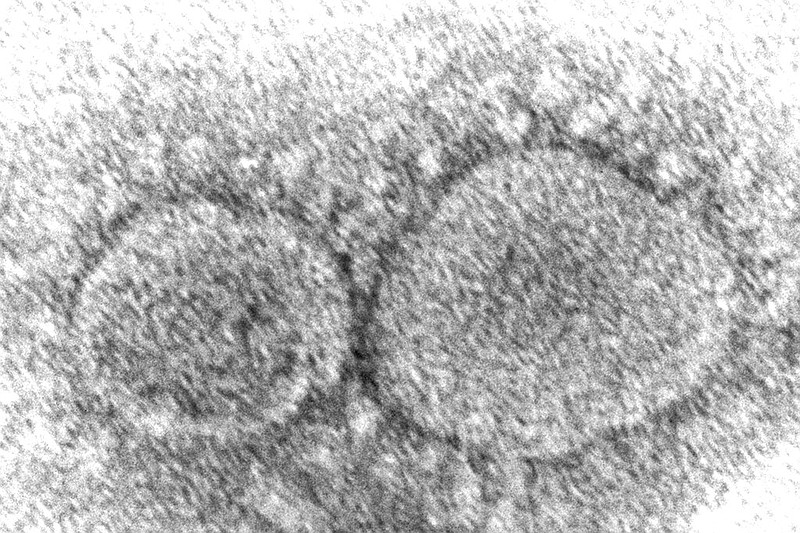 This 2020 electron microscope image made available by the Centers for Disease Control and Prevention shows SARS-CoV-2 virus particles which cause covid-19. According to research released in 2021, evidence is mounting that having covid-19 may not protect against getting infected again with some of the new variants. People also can get second infections with earlier versions of the coronavirus if they mounted a weak defense the first time. (Hannah A. Bullock, Azaibi Tamin/CDC via AP)