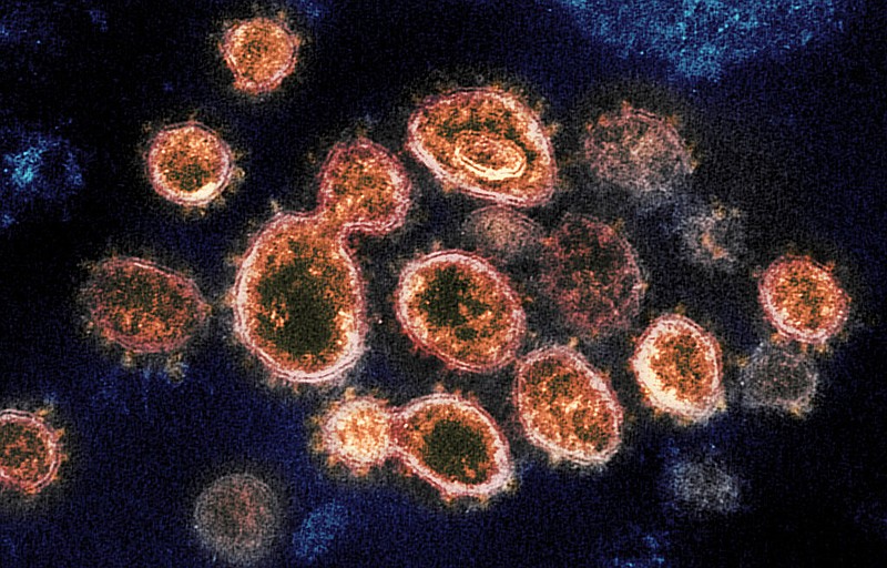 FILE - This 2020 electron microscope image provided by the National Institute of Allergy and Infectious Diseases - Rocky Mountain Laboratories shows SARS-CoV-2 virus particles which cause covid-19, isolated from a patient in the U.S., emerging from the surface of cells cultured in a lab. (NIAID-RML via AP)