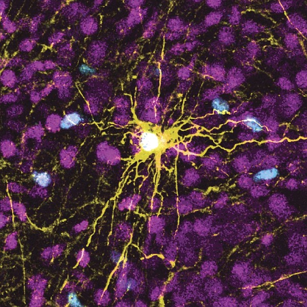 Scientists grow human brain cells in rats to study diseases ...