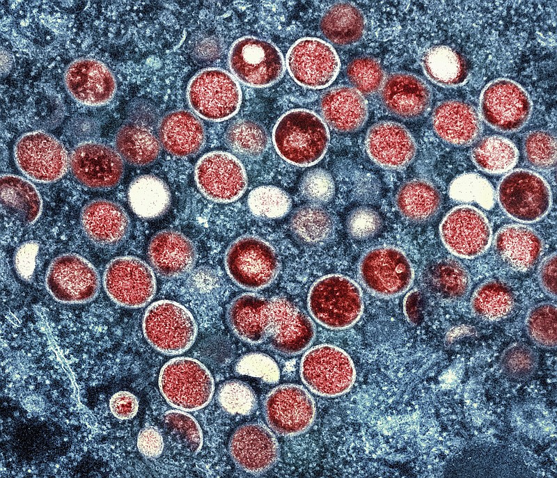 This image shows a colorized transmission electron micrograph of mpox particles (red) found within an infected cell (blue), cultured in the laboratory that was captured and color-enhanced at the NIAID Integrated Research Facility in Fort Detrick, Md.
(AP/NIAID)