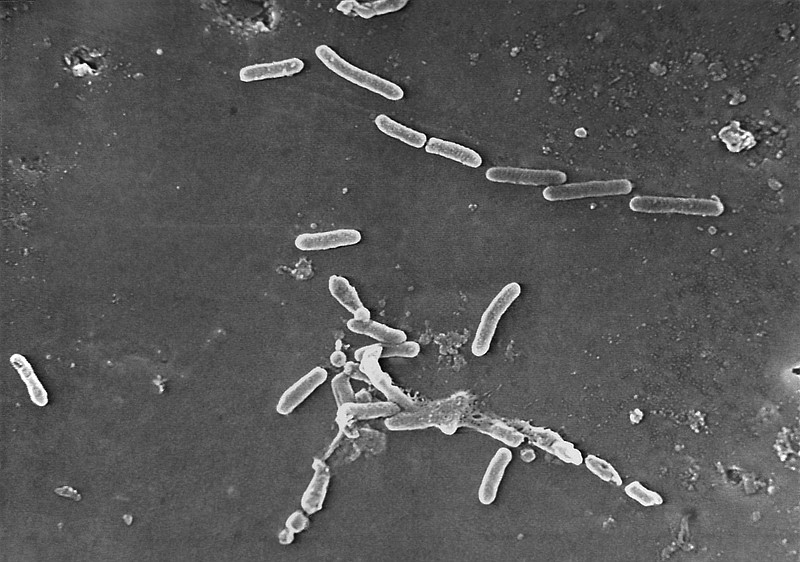 FILE - This scanning electron microscope image made available by the Centers for Disease Control and Prevention shows rod-shaped Pseudomonas aeruginosa bacteria. (Janice Haney Carr/CDC via AP)