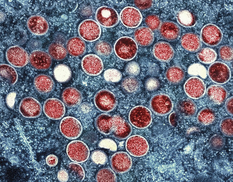 This image provided by the National Institute of Allergy and Infectious Diseases (NIAID) shows a colorized transmission electron micrograph of mpox particles (red) found within an infected cell (blue), cultured in the laboratory that was captured and color-enhanced at the NIAID Integrated Research Facility (IRF) in Fort Detrick, Md. (NIAID via AP, File)