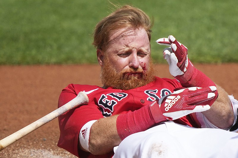 Red Sox infielder Justin Turner hit in face by pitch Jefferson City
