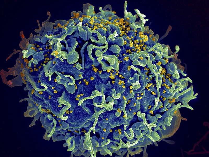 This colorized electron microscope image made available by the U.S. National Institutes of Health shows a human T cell (indicated in blue) under attack by HIV (in yellow), the virus that causes AIDS. (Seth Pincus, Elizabeth Fischer, Austin Athman/National Institute of Allergy and Infectious Diseases/NIH via AP)