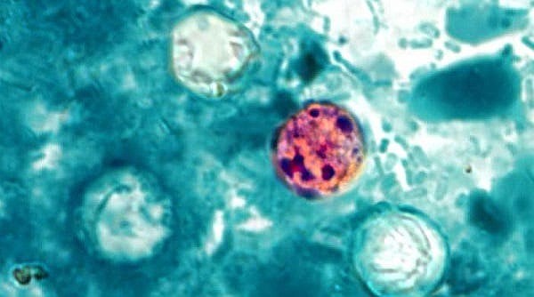 Arkansas sees dip in number of new cyclosporiasis cases