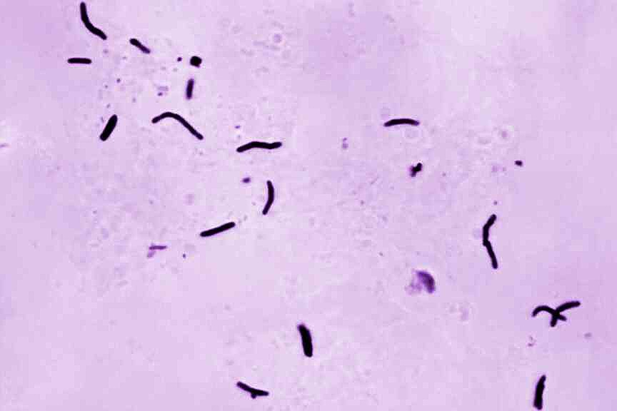 Global tuberculosis diagnoses rise to record, WHO reports