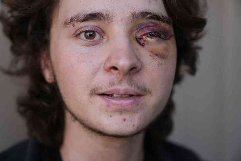California protester left blind in one eye after run-in with federal ...