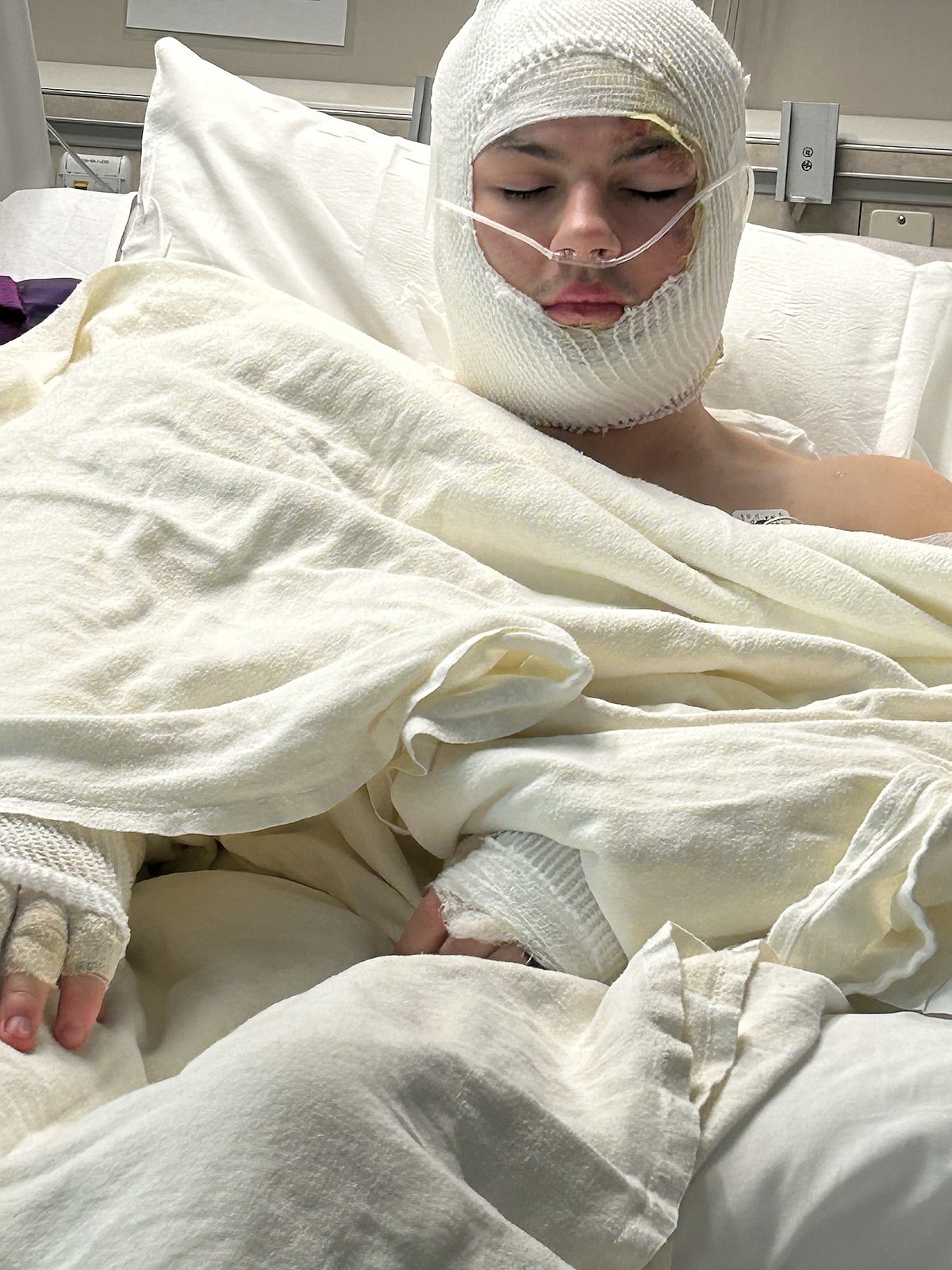 15 teens sent to hospital after Whitfield County bonfire incident