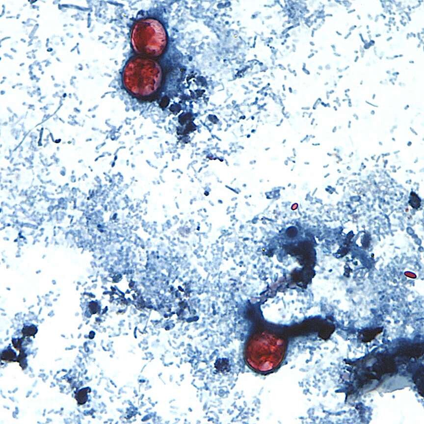 Arkansas reports 14 cases of intestinal parasite, twice 2025’s total, amid national outbreak