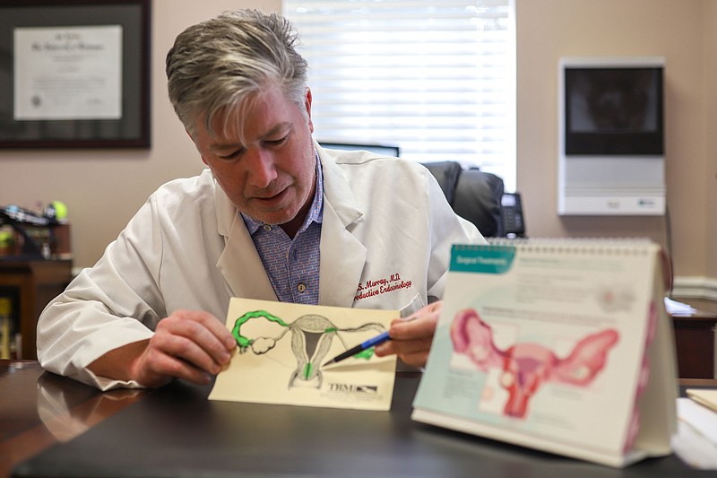 Staff photo by Olivia Ross  / Dr. Rink Murray of Tennessee Reproductive Medicine points to areas of the female reproductive system where pregnancies sometimes implant outside of the uterus, a potentially deadly condition called ectopic pregnancy, on September 9, 2022. Murray is among many Chattanooga doctors who say a new state law has created fear and confusion over treatment for ectopic pregnancy and other pregnancy complications.