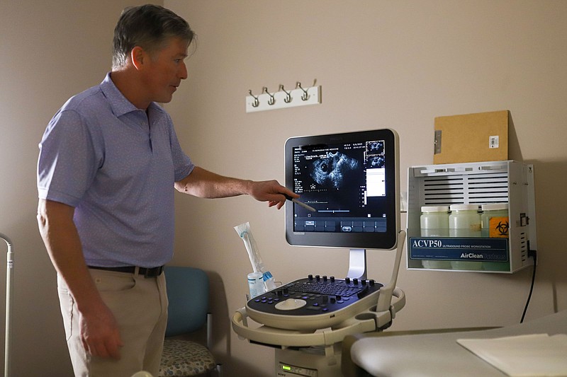 Staff photo by Olivia Ross  / Dr. Rink Murray of Tennessee Reproductive Medicine displays an ultrasound on September 9, 2022. Dr. Murray is a reproductive endocrinologist and infertility specialist.