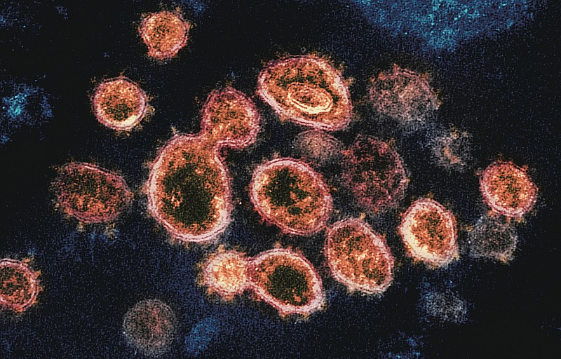This 2020 electron microscope image provided by the National Institute of Allergy and Infectious Diseases - Rocky Mountain Laboratories shows SARS-CoV-2 virus particles which causes covid-19, isolated from a patient in the U.S., emerging from the surface of cells cultured in a lab. Coronaviruses, including the newest one, are named for the spikes that cover their outer surface like a crown, or corona in Latin. Using those club-shaped spikes, the virus latches on to the outer wall of a human cell, invades it and replicates, creating viruses to hijack more cells. (NIAID-RML via AP)
