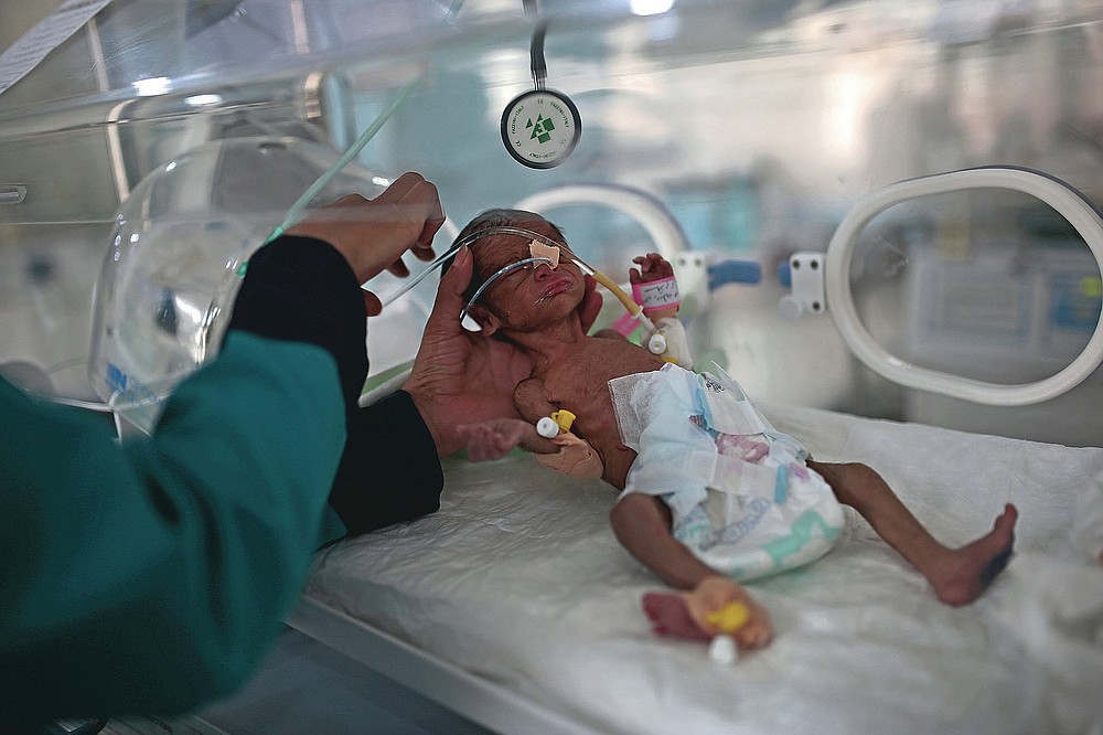 FILE - In this Saturday, June 27, 2020 file photo, a medic checks a malnourished newborn baby inside an incubator at Al-Sabeen hospital in Sanaa, Yemen. A UNICEF report predicted that the number of malnourished children could reach 2.4 million by the end of 2020, a 20% increase. (AP Photo/Hani Mohammed)