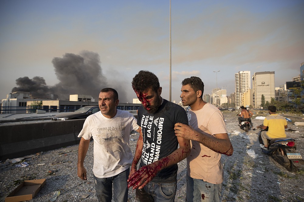 People help a man who was wounded in a massive explosion in Beirut, Lebanon, Tuesday, Aug. 4, 2020. Massive explosions rocked downtown Beirut on Tuesday, flattening much of the port, damaging buildings and blowing out windows and doors as a giant mushroom cloud rose above the capital. Witnesses saw many people injured by flying glass and debris. (AP Photo/Hassan Ammar)