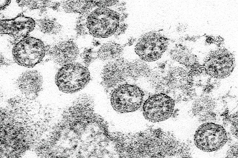 FILE - This 2020 electron microscope made available by the U.S. Centers for Disease Control and Prevention image shows the spherical coronavirus particles from the first U.S. case of covid-19. (C.S. Goldsmith, A. Tamin/CDC via AP)