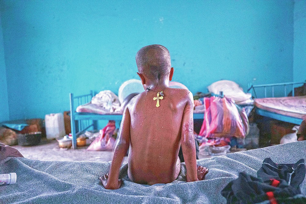 Tigrayan 5-year-old refugee Micheale Gebremariam sits on his bed in the early morning in Hamdayet, eastern Sudan, near the border with Ethiopia, on March 21, 2021. (AP Photo/Nariman El-Mofty)