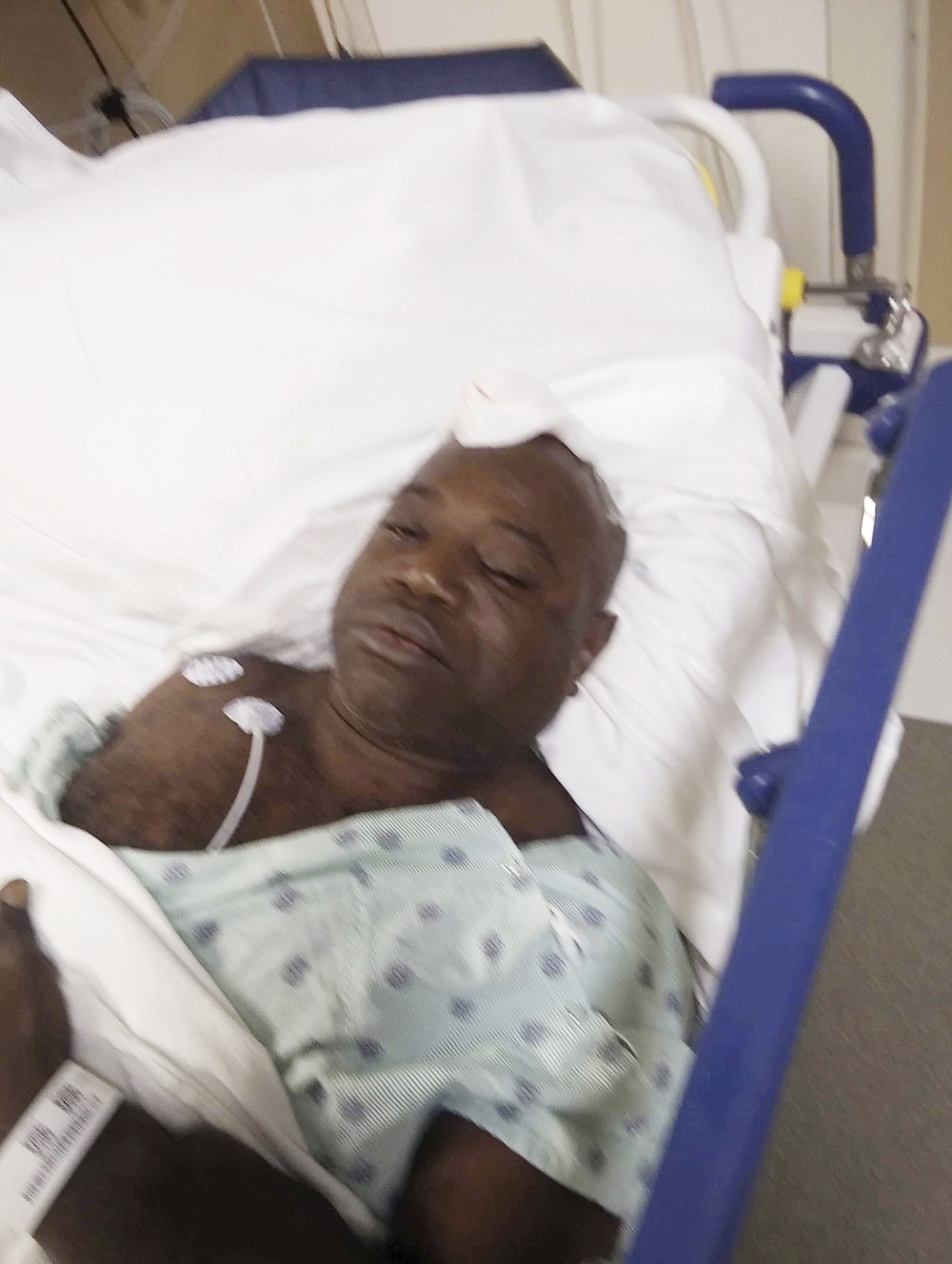 This May 30, 2019 photo provided by his attorneys shows Aaron Bowman at the St. Francis Medical Center in Monroe, La., after, according to court documents, a police officer pummeled Bowman with a flashlight specially designed for shattering car glass, striking him 18 times as he was being handcuffed and not resisting. “I thought I was going to die that night — I bled so much,” Bowman says. “It’s hard to deal with. I can’t function half of the time. It’s just hard for me to think now.” (AP Photo)